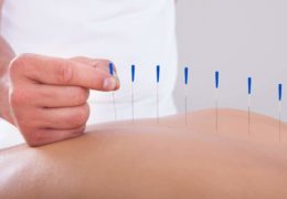 The Benefits of Acupuncture on Fertility