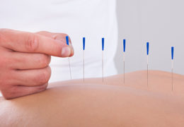 Harnessing Balance: Acupuncture in Addressing Depression and Sadness