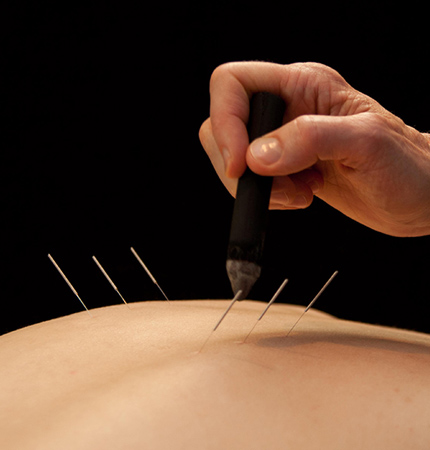 Acupuncture stimulates the flow of oxygen and other nutrients through the body to encourage healing.