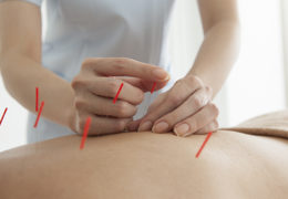 Acupuncture Treatment for Pain