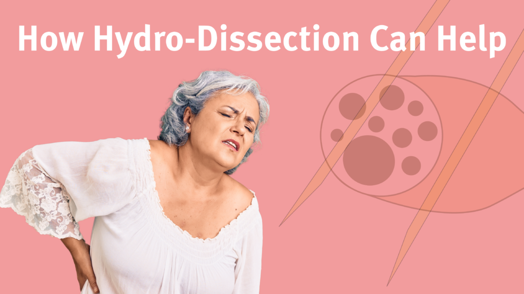 How hydro-dissection can help