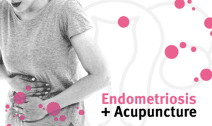 Acupuncture endometriosis