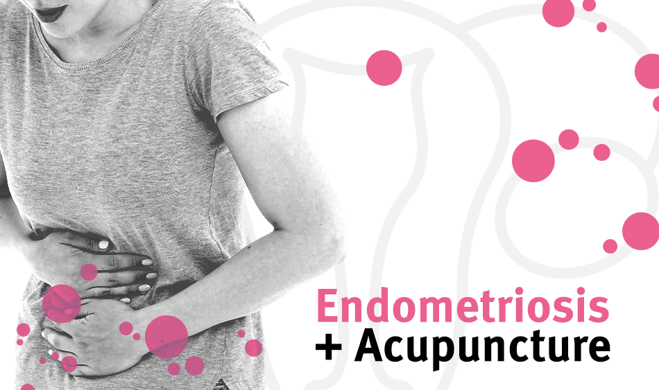 Acupuncture endometriosis
