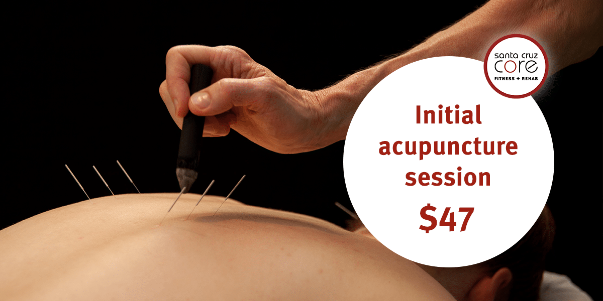 Initial acupuncture session for $47