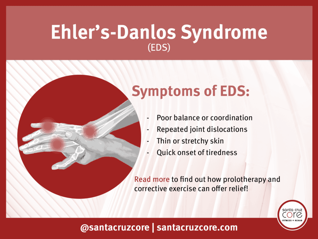 eds ehler's danlos syndrome prolotherapy corrective exercise help