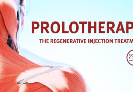 Prolotherapy: The Regenerative Injection Treatment
